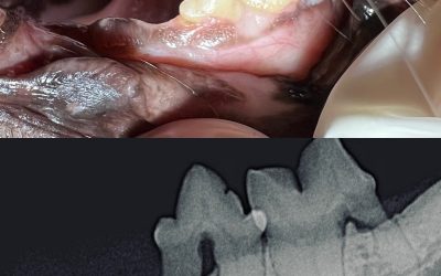 Ohne Dentalröntgen keine professionelle Zahnbehandlung!